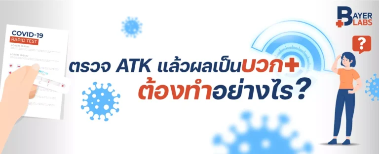 ตรวจ ATK แล้วผลเป็นบวกต้องทำอย่างไร